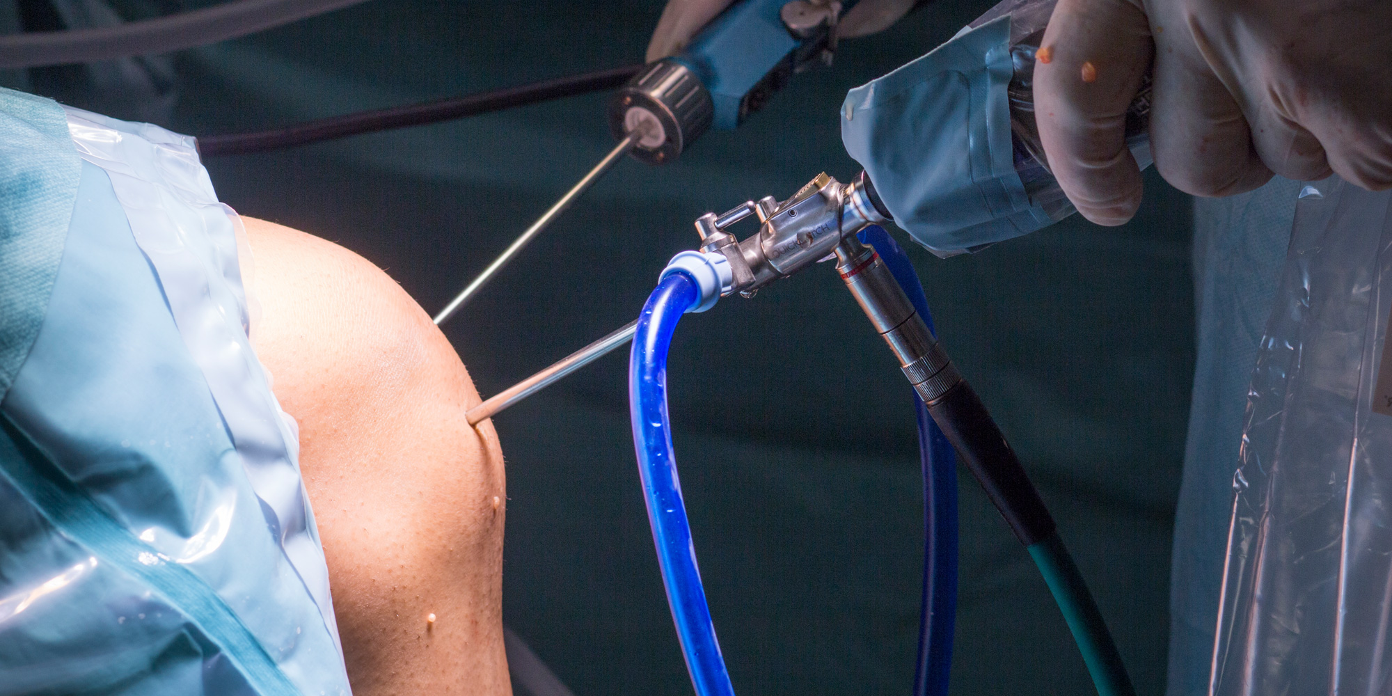 Knee-Arthroscopy